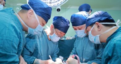 猪肝移植 中国男子 170天