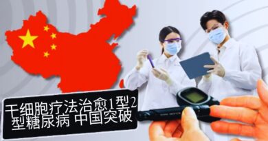 干细胞疗法治愈糖尿病