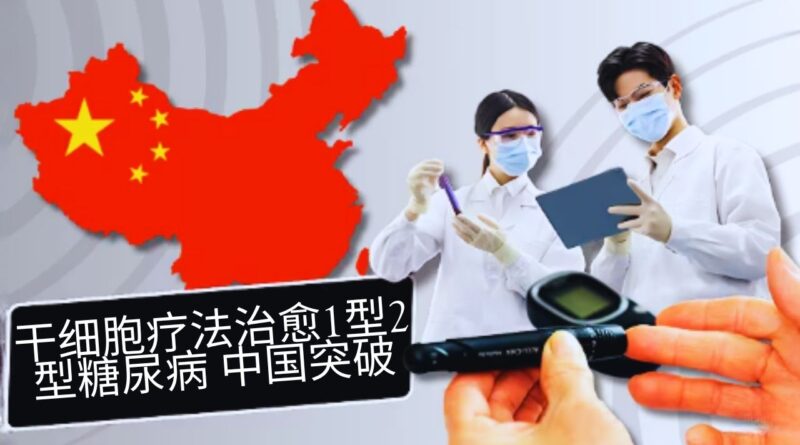 干细胞疗法治愈糖尿病